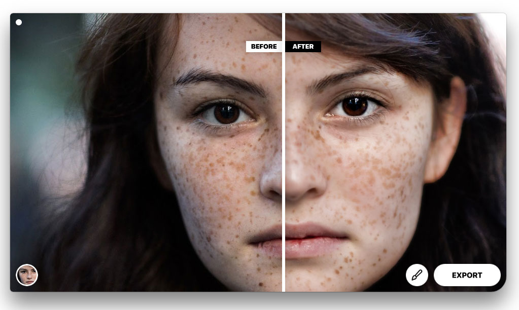 remove freckles with photolemur